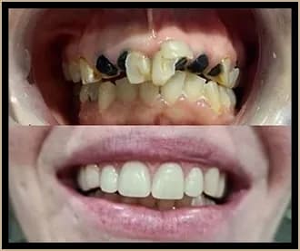 Boutique Dental Implants and Cosmetics - Campbelltown - Image 2