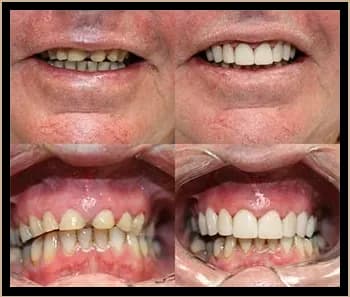 Boutique Dental Implants and Cosmetics - Campbelltown
