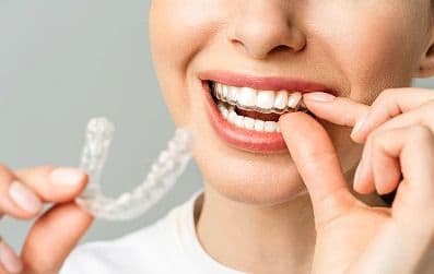 Whistle Aligners - Image 2