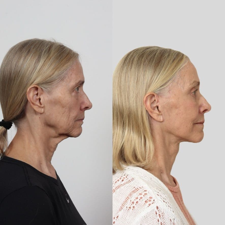 Locketz Facial Plastic Surgery - Image 5