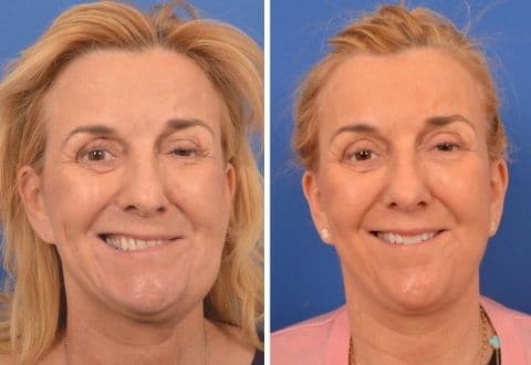 The Facial Paralysis Institute - Image 5
