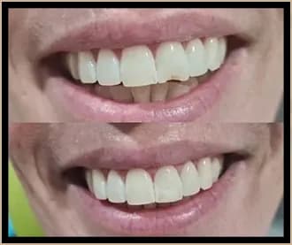 Boutique Dental Implants and Cosmetics - Campbelltown - Image 3
