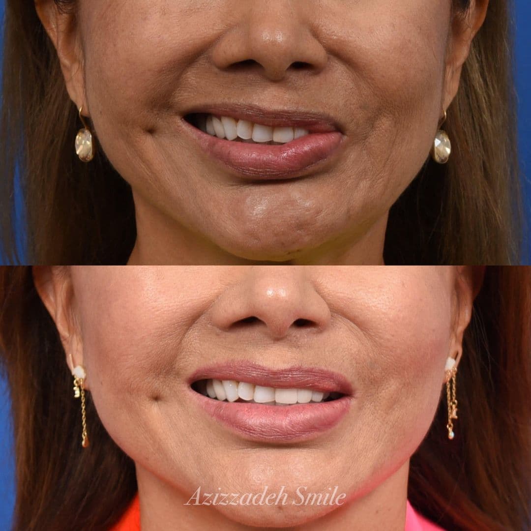 The Facial Paralysis Institute - Image 3