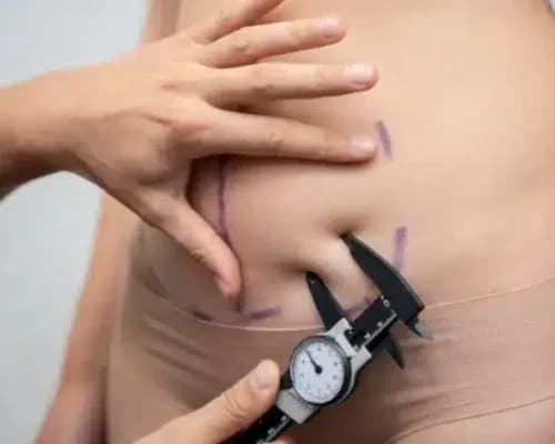 Dr Atta Plastic Surgeon - Image 5