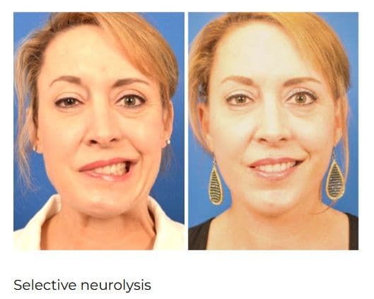 The Facial Paralysis Institute - Image 2