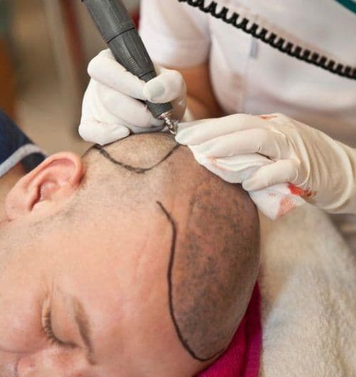Dr Atta Plastic Surgeon - Image 3