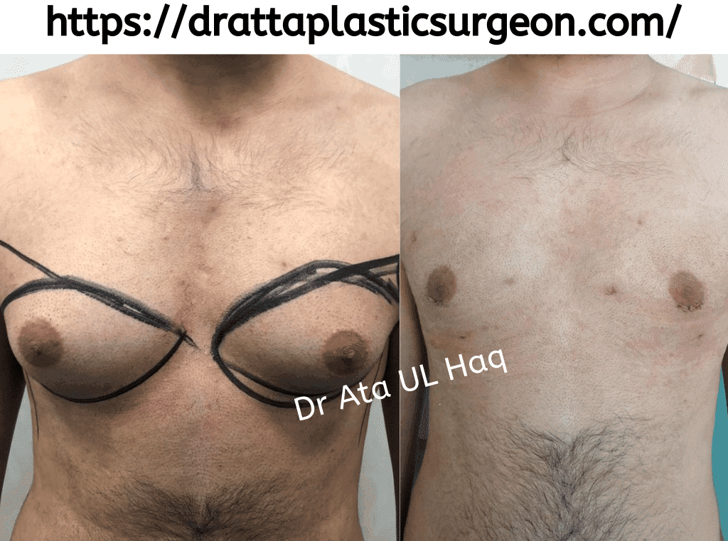 Dr Atta Plastic Surgeon - Image 2