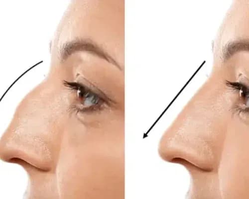 Dr Atta Plastic Surgeon - Image 4