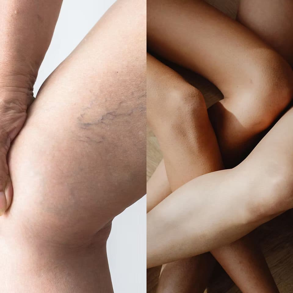 Precision Vein & Vascular - Image 2