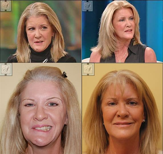 The Facial Paralysis Institute - Image 4
