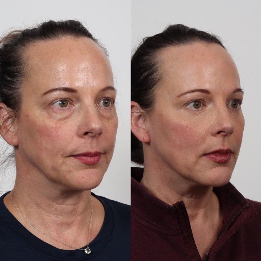 Locketz Facial Plastic Surgery - Image 3